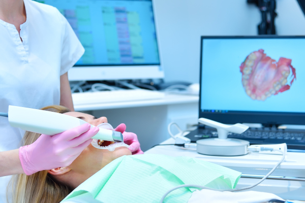 Scanner intra-oral iTero
