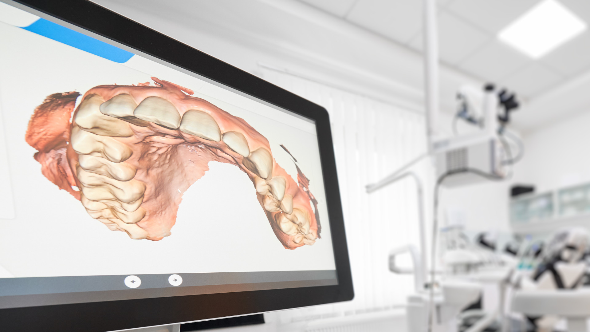 Scanner intra oral et imagerie 3D